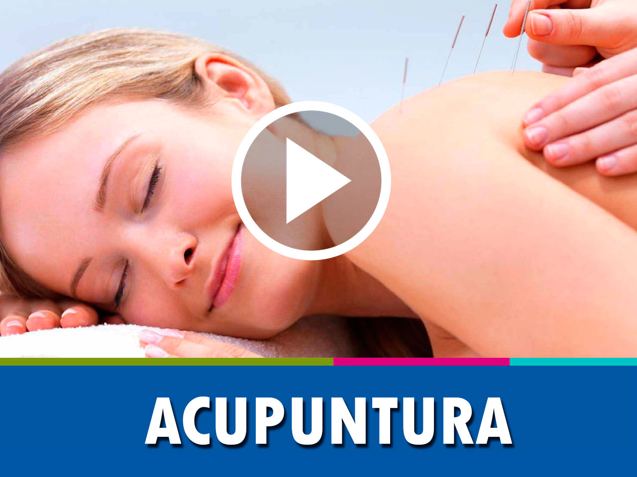 Acupuntura