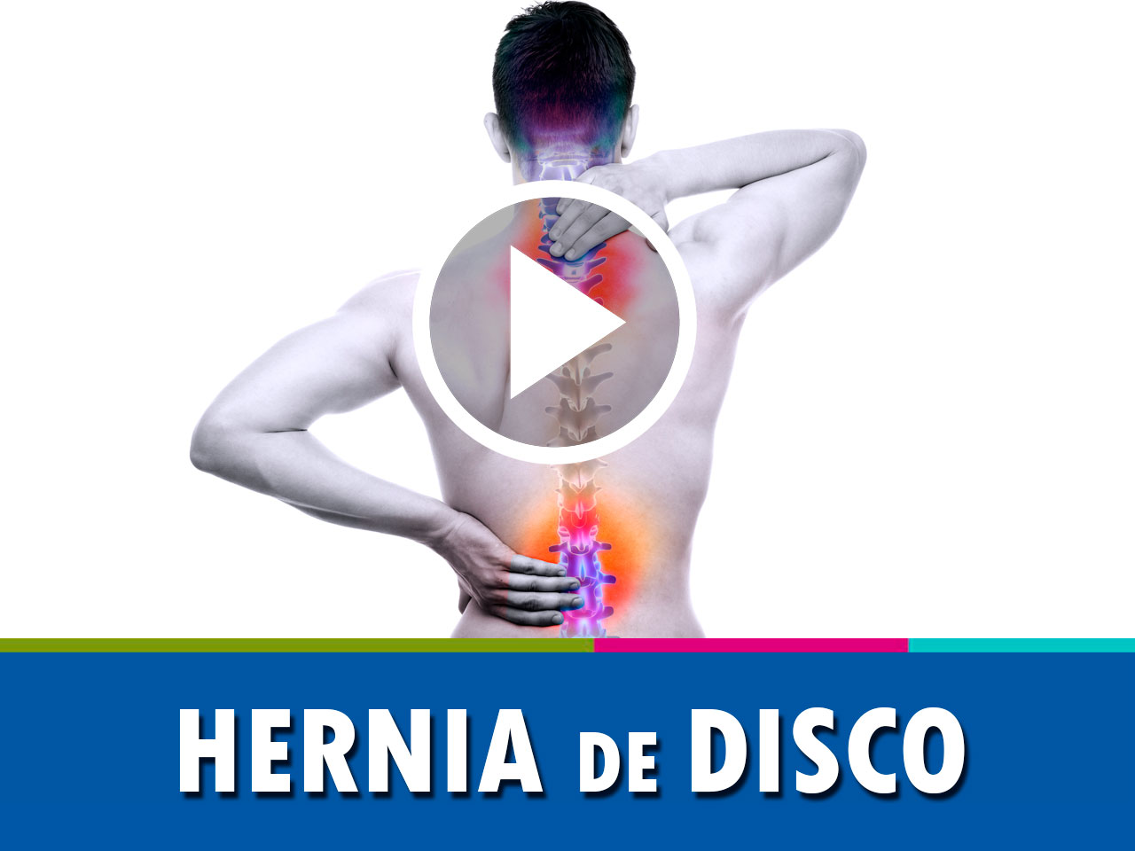 Hernia de Disco
